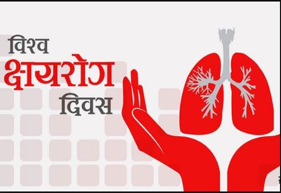 विश्व क्षयरोग दिवस: सन् २०५० सम्म नेपाललाई क्षयरोग मुक्त बनाइने