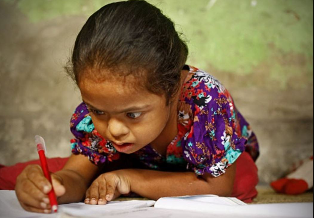 अटिजम रोग हो कि समस्या मात्रै ?